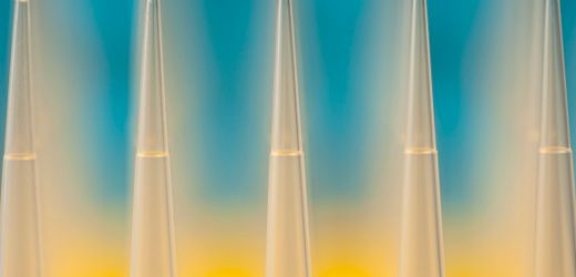 Vitamin D, Allergien, Schwermetalle: Was taugen Selbsttests aus der Drogerie?