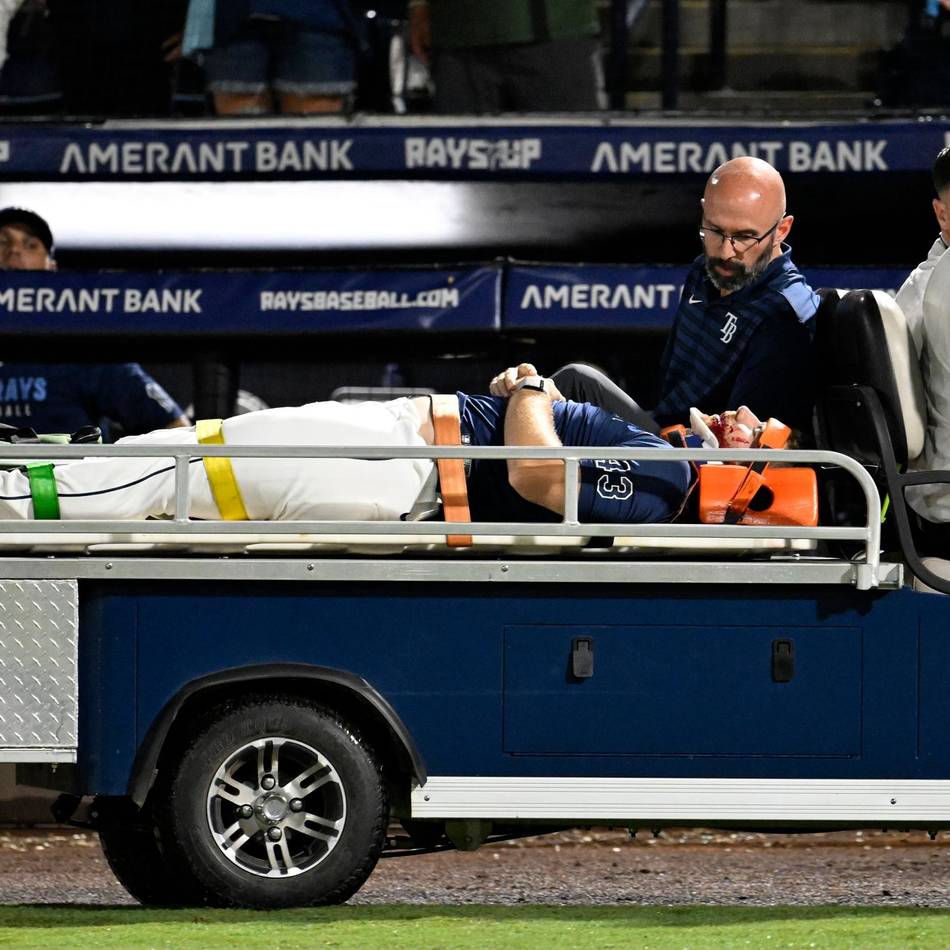 Querschläger in der MLB: Baseball-Profi nach hartem Gesichtstreffer im Krankenhaus