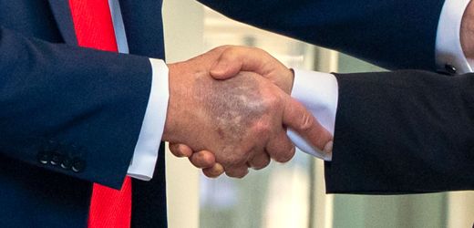 USA: Donald Trump erneut mit deutlichem Bluterguss an der Hand fotografiert
