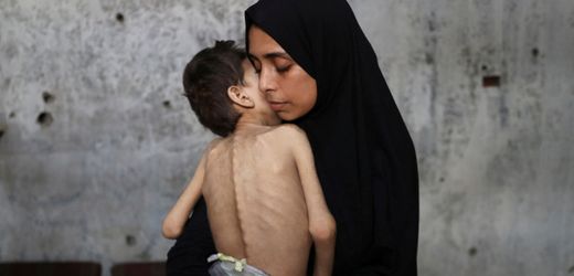Gaza: Der Hunger ist echt, die Bilder sind es auch