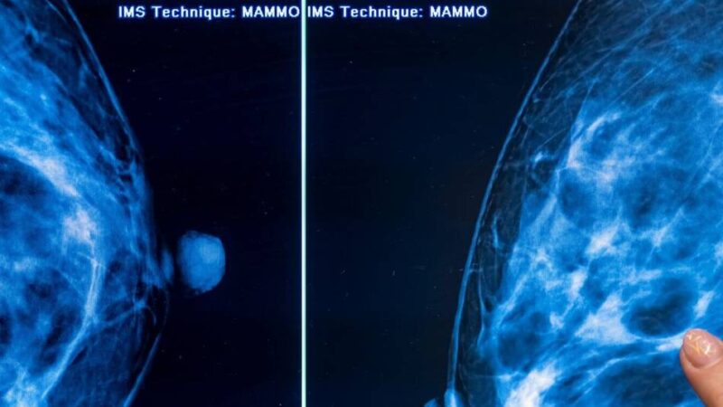 Zwölfte Auflage: Klever Brusttag informiert und stärkt Betroffene