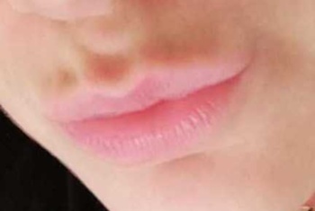 Sweet-Kiss