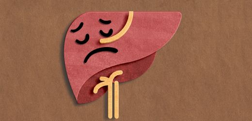 Fettleber: »Wollen Sie mit 65 einen Herzinfarkt haben oder mit Ihren Enkeln spielen?«