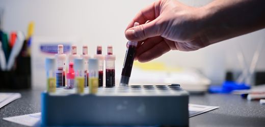HIV: Forschende finden breit wirksame Antikörper