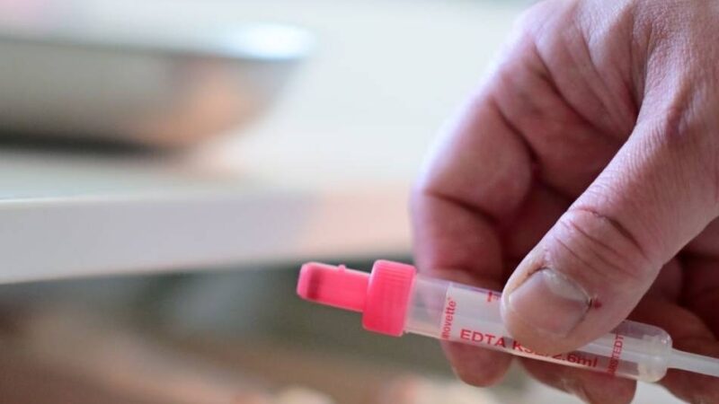 Gesundheits-Prävention: Kreis Viersen beteiligt sich an HIV-Testwoche