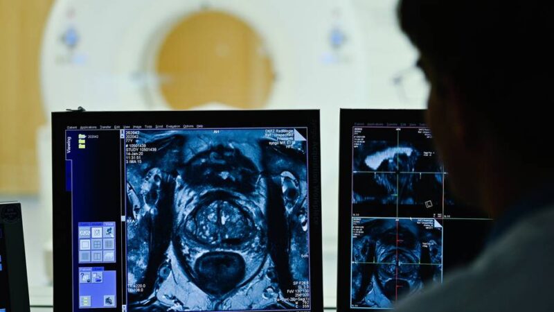 Projekt im Kreis Wesel: Umfrage zur Krebs-Früherkennung bei Männern