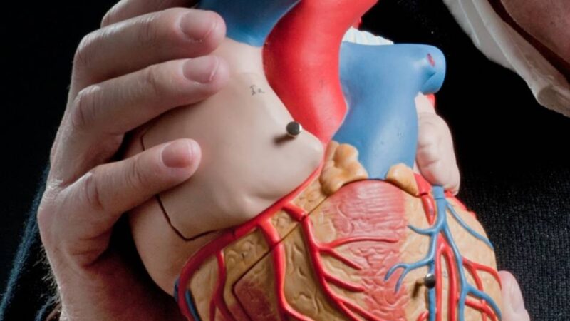 Herzseminar in Kempen: „Frauen kommen oft viel zu spät ins Krankenhaus“