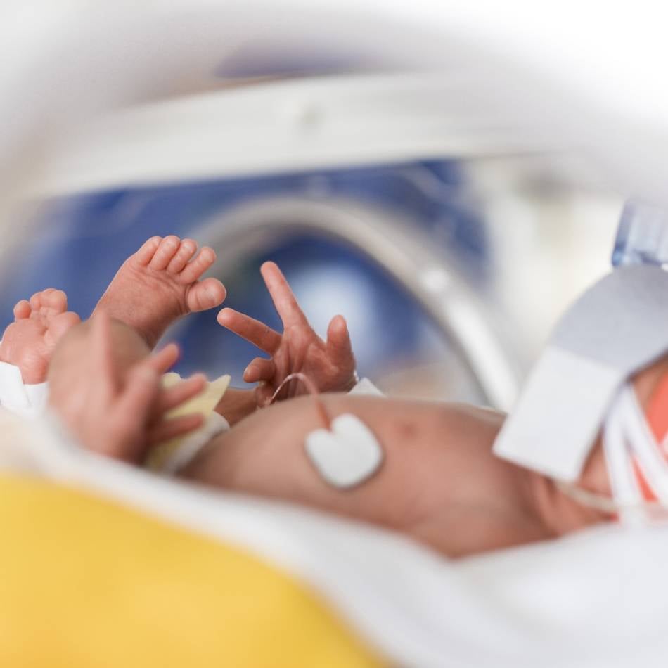 Geburten in Düsseldorf : Begleitung für einen schweren Start ins Leben