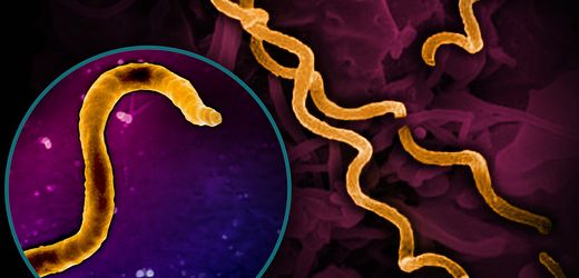 Kolumbien: Mit Abstand ältester Syphilis-Erreger entdeckt