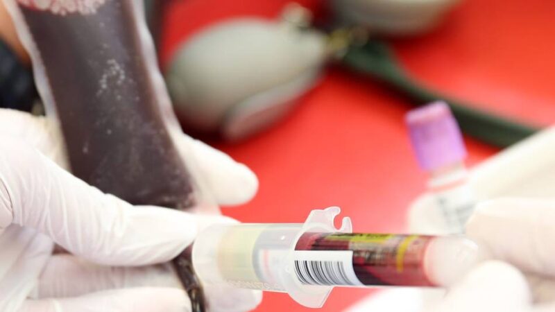 DRK und Krankenhäuser zur Lage: Warum Blutspenden in Mönchengladbach gerade besonders knapp sind