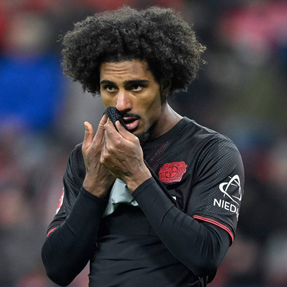 Englische Wochen für Bayer: Hjulmands Rotations-Gedanken vor Union Berlin