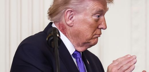 Donald Trump: Fleck am Hals befeuert Spekulationen über Gesundheitszustand des US-Präsidenten