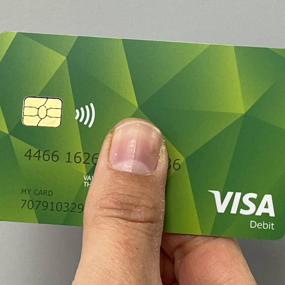 Auch Kevelaer will sie einführen: „Es gibt keine Stigmatisierung“ – Erfahrungen mit der Bezahlkarte für Geflüchtete