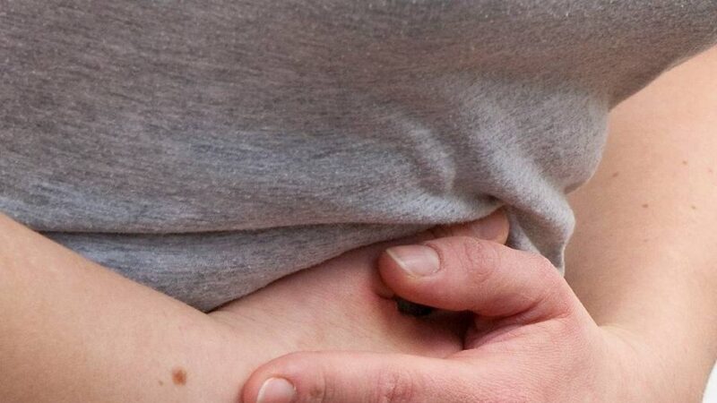 Kolumne Iss dich gesund!: Reizdarm – das stille Volksleiden