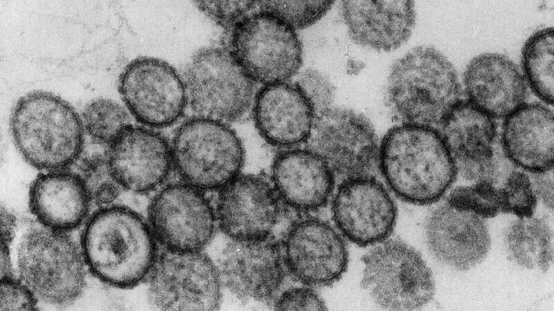 Klinik-Mitarbeiter in Quarantäne: Hantavirus in Nimwegen: So ist der Kreis Kleve darauf vorbereitet