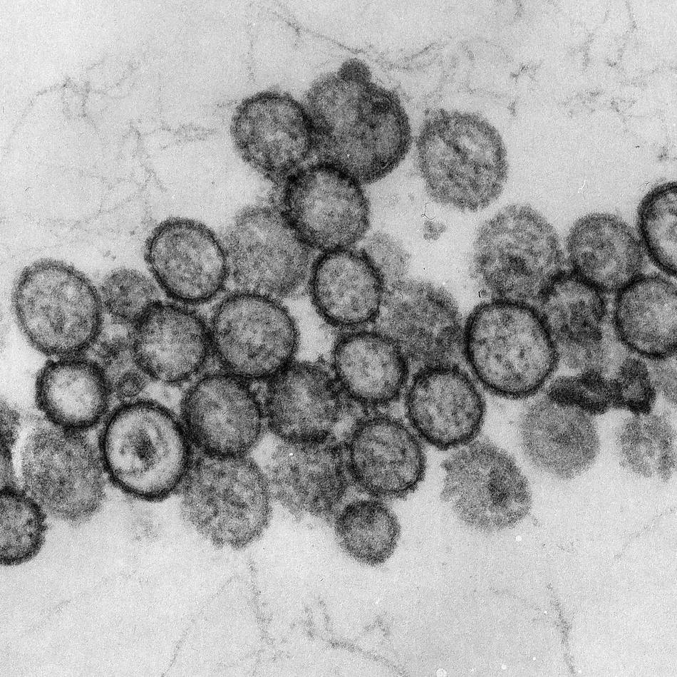 Klinik-Mitarbeiter in Quarantäne: Hantavirus in Nimwegen: So ist der Kreis Kleve darauf vorbereitet