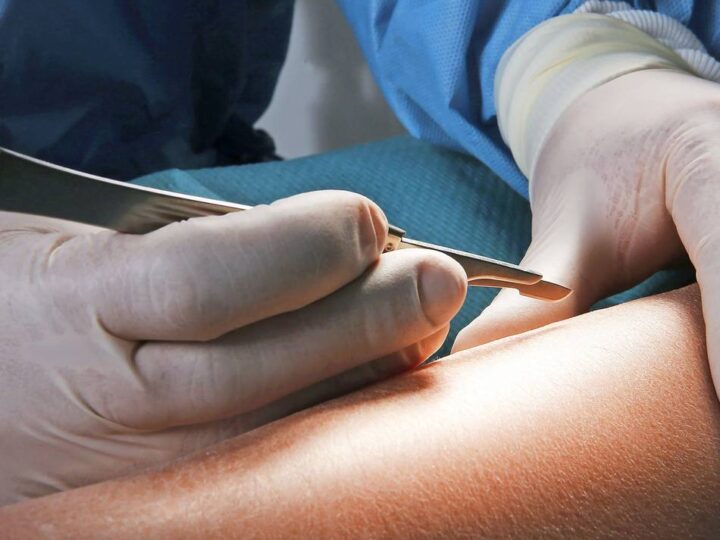 Kritik von bergischen Krankenkassen: „Es wird zu viel abgewälzt“