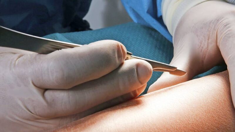 Kritik von bergischen Krankenkassen: „Es wird zu viel abgewälzt“