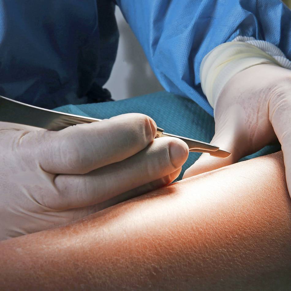 Kritik von bergischen Krankenkassen: „Es wird zu viel abgewälzt“