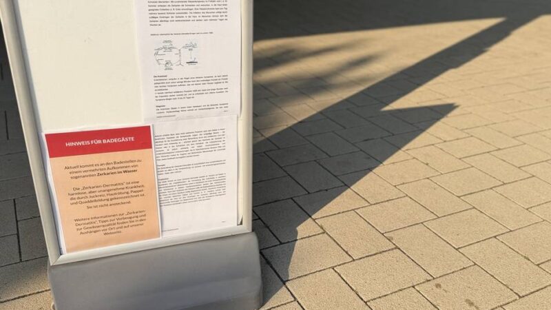 „Hinweise für Badegäste“: Zerkarien in Xantener Südsee – FZX informiert vor Ticketkauf