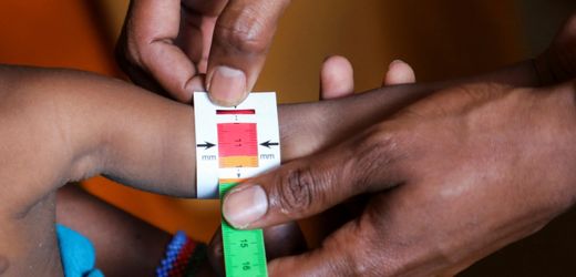 Somalia: Jedes zweite Kind ist laut Ärzte ohne Grenzen mangelernährt